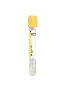 Mynd Vacutainer SST II Advanced blóðtökuglas 5 ml